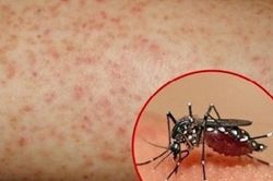 Cô gái 19 tuổi liên tục ho ra máu vì sốt xuất huyết