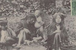 Ảnh = Ký ức = Lịch sử (Kỳ 56): Bắt chấy
