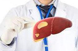 Rối loạn chuyển hóa làm gia tăng bệnh lý gan nhiễm mỡ