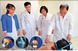 Phẫu thuật thành công ca gù vẹo cột sống nặng