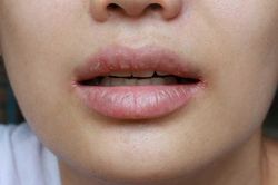 2 dấu hiệu xuất hiện cả ngày lẫn đêm chính là do bệnh tiểu đường, không cần xét nghiệm cũng biết