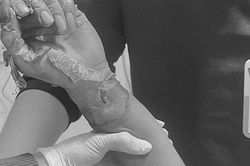 'Cần thủ' bị bỏng nặng vì câu cá dưới đường điện