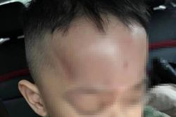 Xác minh thông tin trẻ bị bạo hành ở trường mầm non tại Đà Nẵng