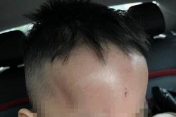 Đà Nẵng: Cơ quan chức năng xác minh vụ việc phụ huynh phản ánh trẻ bị bạo hành