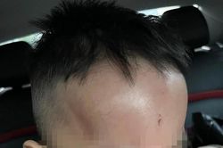 Công an xác minh vụ việc phụ huynh phản ánh trẻ bị bạo hành