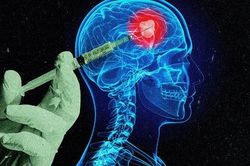 Phát triển vaccine điều trị và ngăn ngừa ung thư não