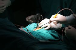 Cứu sống bé trai bị kéo thủ công đâm thủng hộp sọ
