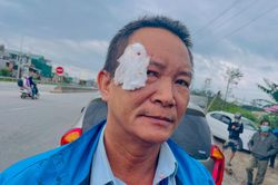 Tài xế nhà xe Sơn Tùng bị đánh khi đón khách ven đường