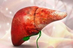 Gan thải độc nhưng lại dễ bị nhiễm độc: Thấy có dấu hiệu này phải lập tức đi gặp bác sĩ ngay còn kịp