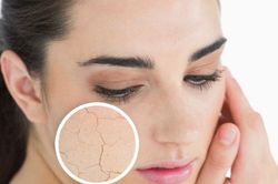 Dấu hiệu cơ thể bị thiếu nước trầm trọng