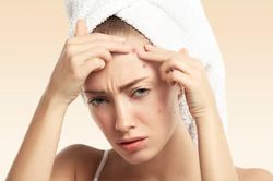 Mụn bùng phát trên da vì thói quen sai lầm