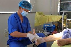 Cách xử trí biến chứng bàn chân đái tháo đường