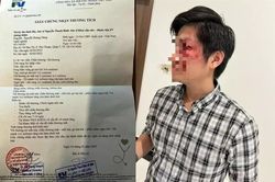 Góc nhìn pháp lý vụ chủ chó hành hung người cha bảo vệ con