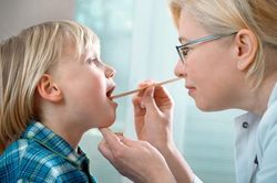 Điều trị viêm VA và những điều cần biết
