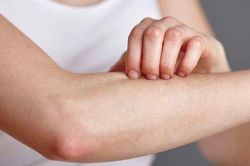 Các bệnh da liễu dễ mắc phải khi thời tiết nồm ẩm