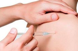 Điểm mặt các nguyên nhân gây đau khớp vai
