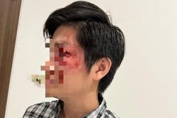 UBND TP HCM yêu cầu xử lý nghiêm vụ chủ chó đánh người dân nhập viện