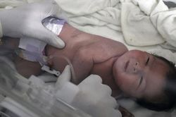 Bé gái Syria chào đời trong đống đổ nát của tòa nhà bị sập, dây rốn vẫn nối với bánh nhau trong bụng mẹ