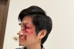 Vụ chủ chó thả rông hành hung cư dân: Giám định thương tích nạn nhân Nguyễn Hoàng Dũng