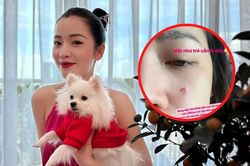 Puka bị rách mặt vì thú cưng tấn công bất ngờ