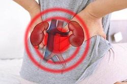 Cận cảnh viên sỏi thận to hiếm gặp trong thận người phụ nữ, chuyên gia cảnh báo cần điều chỉnh ngay thói quen này!