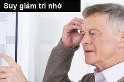 Dấu hiệu nhận biết bệnh sa sút trí tuệ qua các giai đoạn
