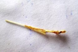 Cô gái trẻ mời thầy về 'làm phép' chữa hóc xương gà