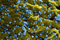 WHO tăng cường giám sát sau khi Guinea Xích đạo công bố dịch bệnh do virus Marburg