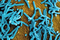 Virus Marburg gây tử vong cao nhưng không dễ lây