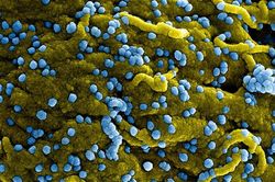 Virus Marburg có khả năng lây sang Việt Nam không?