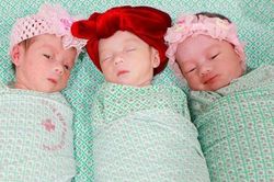 Ca sinh 3 tự nhiên cùng trứng hiếm gặp