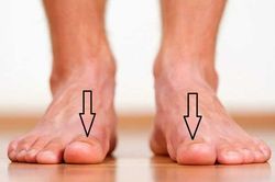 Bàn chân xuất hiện cùng lúc 3 dấu hiệu này: Cảnh báo thận đang 'kêu cứu' gấp, hãy đi kiểm tra ngay