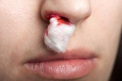 7 triệu chứng không đau nhưng có thể là dấu hiệu sớm của ung thư, hãy nhanh chóng đi gặp bác sĩ
