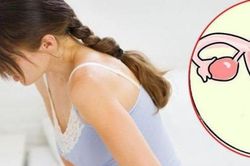 Dấu hiệu nhận biết u xơ tử cung, chị em cần biết để đi khám ngay