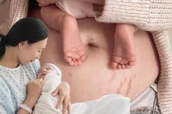 8 món phụ nữ sau sinh nên tích cực ăn để mờ vết rạn, da trắng mịn