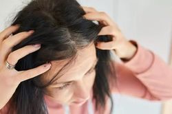 Tại sao chỉ sau một đêm có người bạc trắng đầu?