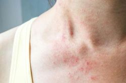 Người bị tiểu đường khi tập thể dục cần làm điều này để tránh tăng, hạ đường huyết