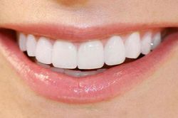 7 loại thực phẩm giúp răng trắng bóc giúp nàng có được nụ cười tươi sáng hơn