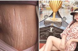 Vợ Phan Văn Đức đăng ảnh vết rạn sau sinh, nói lên tiếng lòng của người làm mẹ khiến cộng đồng mạng xúc động