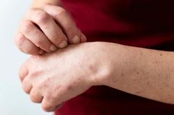 Thường xuyên ngứa ngáy 3 chỗ này cảnh báo tiểu đường