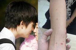 Bé 14 tuổi nhiễm HIV, giang mai, nghi sùi mào gà: Cảnh báo quan hệ tình dục sớm ở tuổi vị thành niên