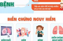 Phát hiện hơn 1.000 trẻ mắc virus hợp bào hô hấp