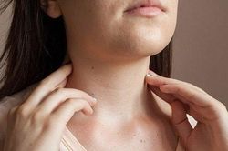 Thói quen cần có để ngăn ngừa nếp nhăn vùng cổ