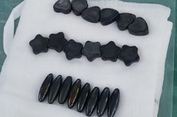 Nuốt 20 viên nam châm, bé trai phải cắt 15cm ruột