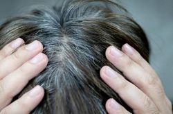 Tóc bạc sớm có phải do 'máu xấu'?