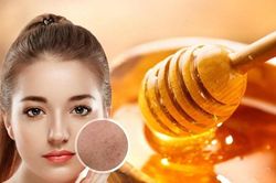 4 cách đánh bay mụn, giúp da trắng sáng mịn màng từ mật ong
