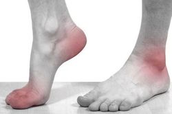 5 dấu hiệu ở chân cảnh báo bệnh nguy hiểm: Ai không có thật đáng chúc mừng