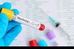 Giám sát chặt nguy cơ lây lan virus Marburg vào Việt Nam