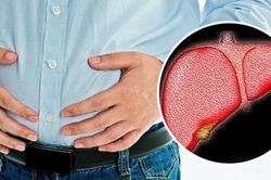 Gan nhiễm mỡ gây nên các bệnh gì?