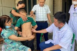 Hàng trăm người ở Hà Tĩnh bị côn trùng 'lạ' cắn gây viêm da dị ứng